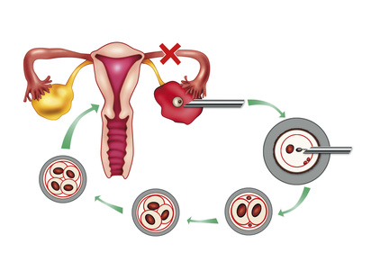 Testosterone symptoms